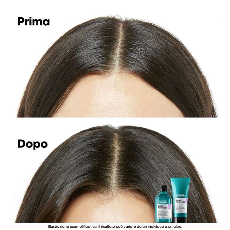 SERIE EXPERT 2021 SCALP ADVANCED SHAMPOO ANTI-DISCOMFORT