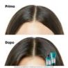 SERIE EXPERT 2021 SCALP ADVANCED SHAMPOO ANTI-DISCOMFORT